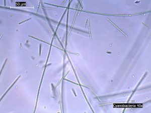 Cyanobacteria under microscope 