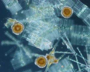   Freshwater phytoplankton, mainly Diatoms and Dinoflagellates